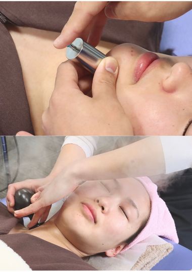 肌再生美容鍼