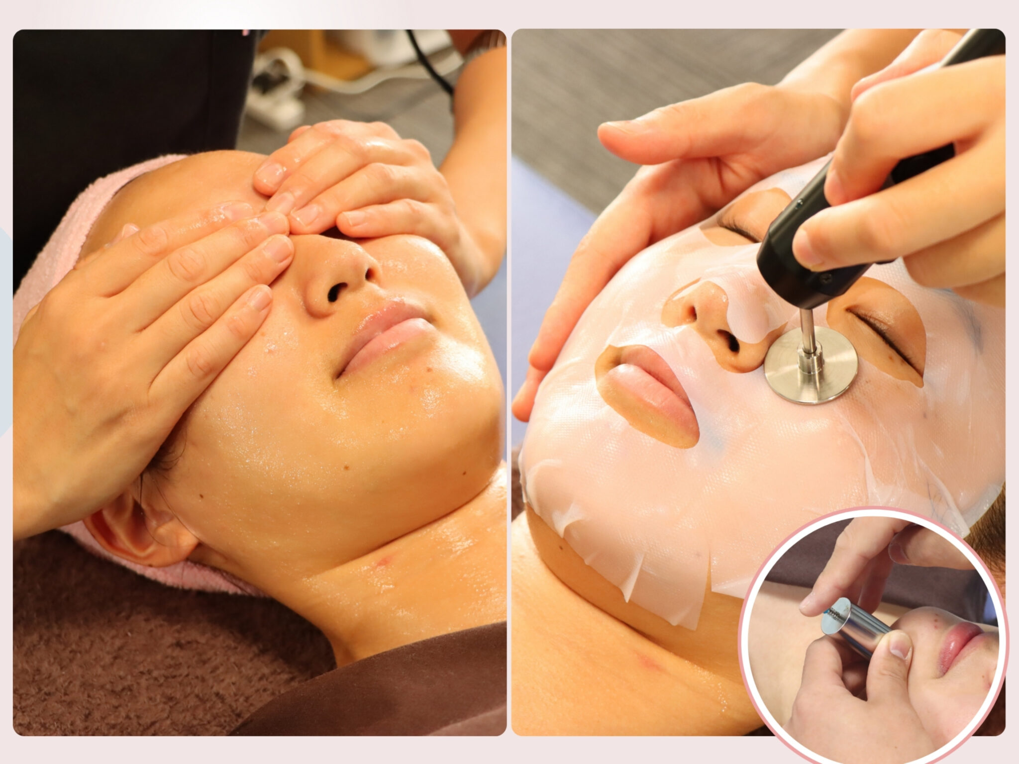 目の下のたるみは、年齢より5歳老けて見える？